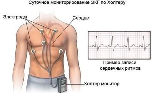 Оценка здоровья и физической формы сердечно-сосудистой системы